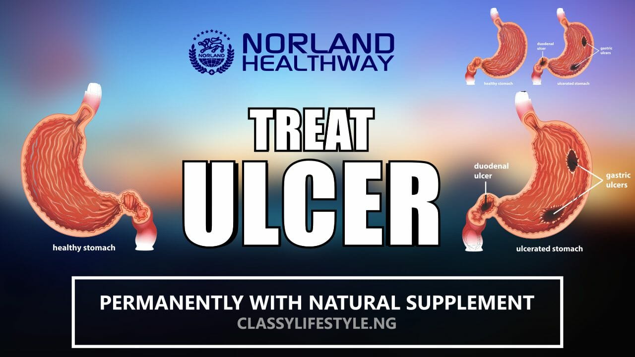 TREAT STOMACH ULCER PERMANENTLY WITH NATURAL SUPPLEMENT - NORLAND GI VITAL SOFT GEL, PORT HARCOURT
