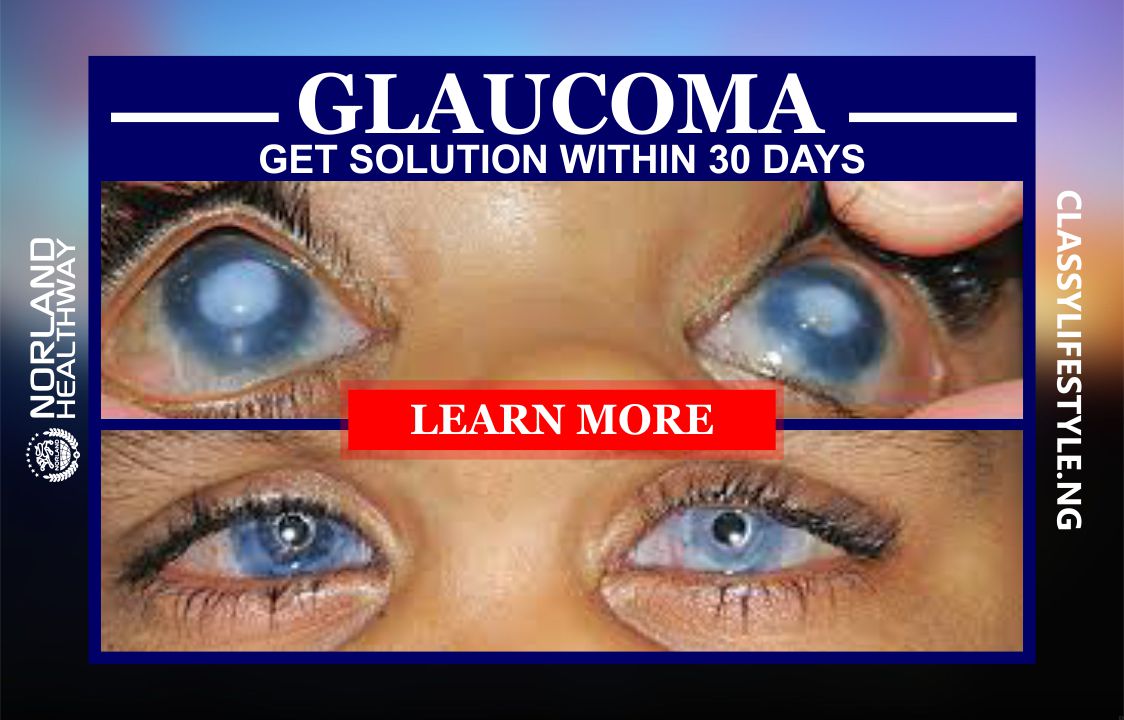 Norland Product For Glaucoma & Cataract (Eye Problem) Port Harcourt