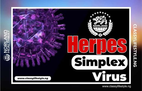 Norland Products For Herpes HSV - Natural Solution-min